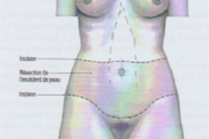 chirurgie réparatrice